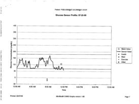 Graph of Tuesday glucose sensor results